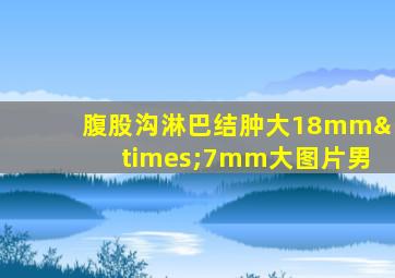 腹股沟淋巴结肿大18mm×7mm大图片男